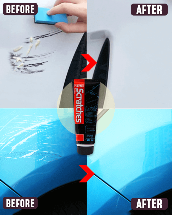 Auto Resurfacing Polish Set