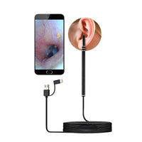 Visual Ear Cleaning Scope with Camera