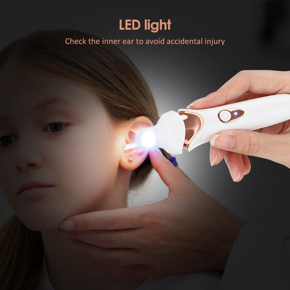 QuietEar Gentle Ear Wax Vacuum for Safe Removal at Home