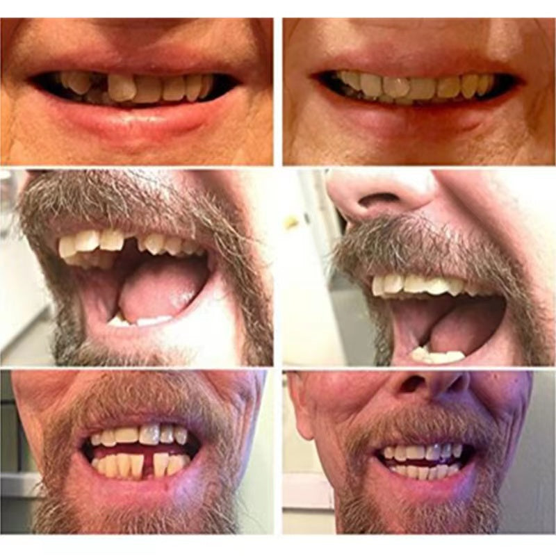 Wearclo | High-Quality False Teeth
